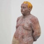 HANNES MUSSNER - Patrick